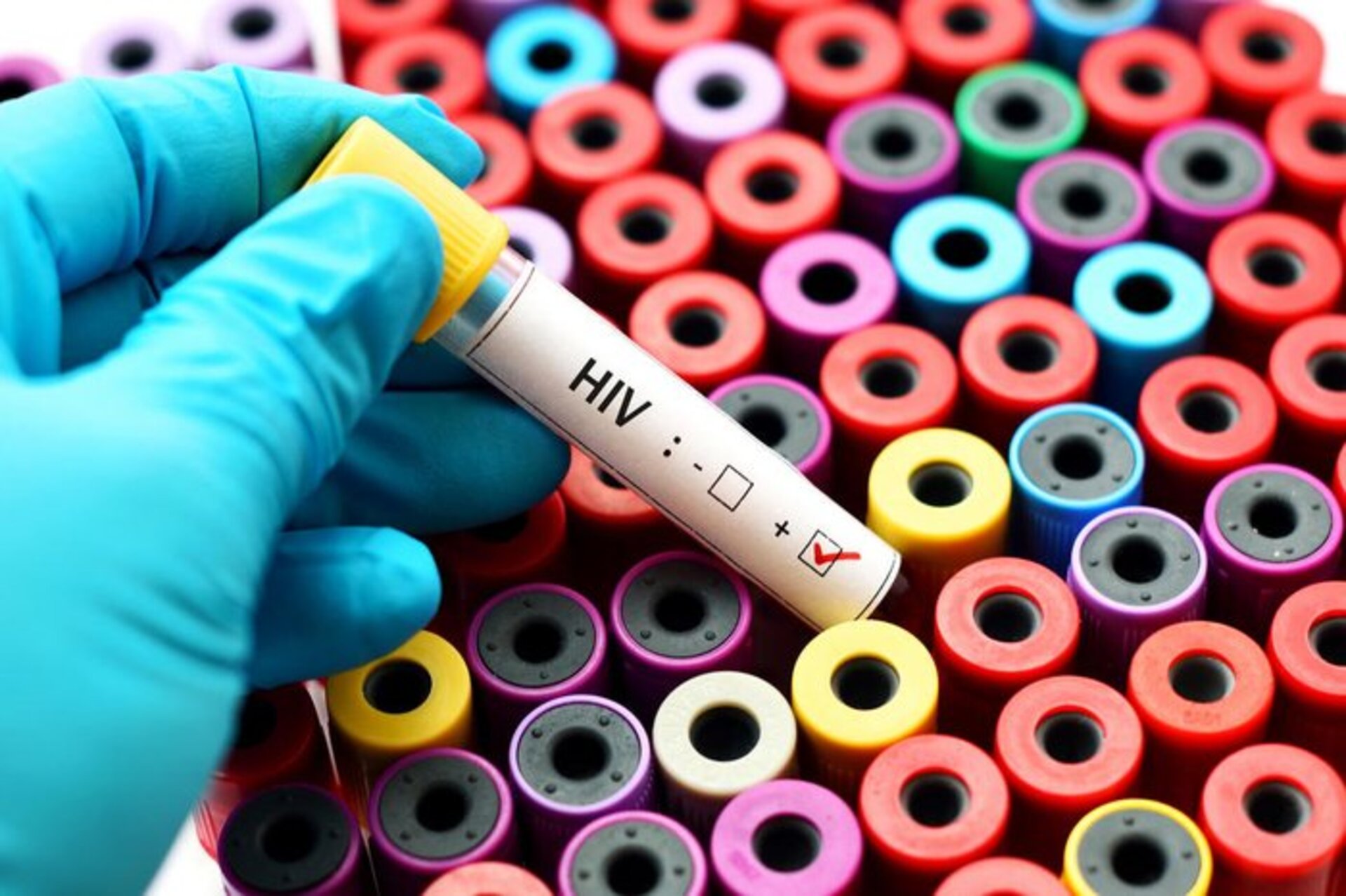 Mesmo que a vacina fosse segura, ela não era mais eficaz contra o HIV do que um placebo.