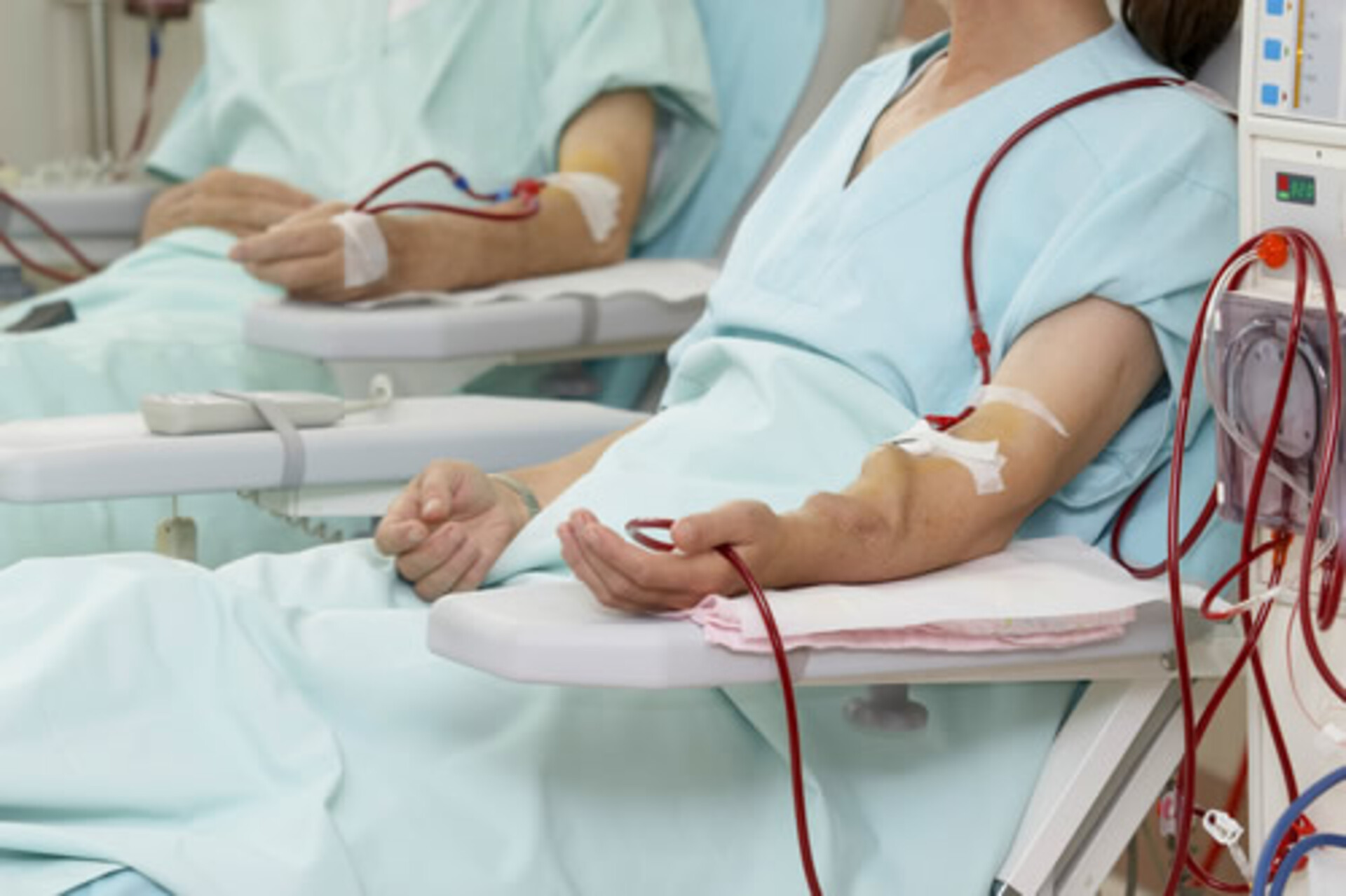 PL considera como doença renal crônica a lesão renal progressiva e irreversível.