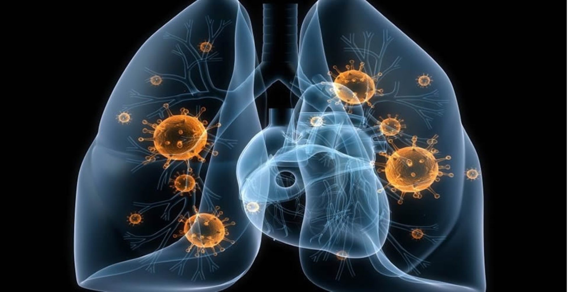 Em Uruguaiana, a Secretaria de Saúde registrou 32 casos de tuberculose em 2023.
