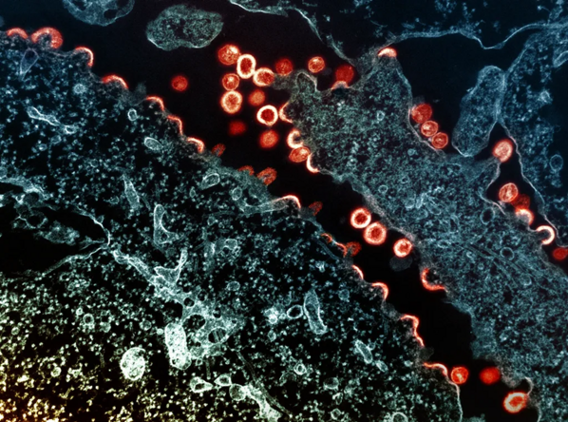 Atualmente, os tratamentos recebidos pelas pessoas HIV-positivas levam ao estado indetectável do vírus.