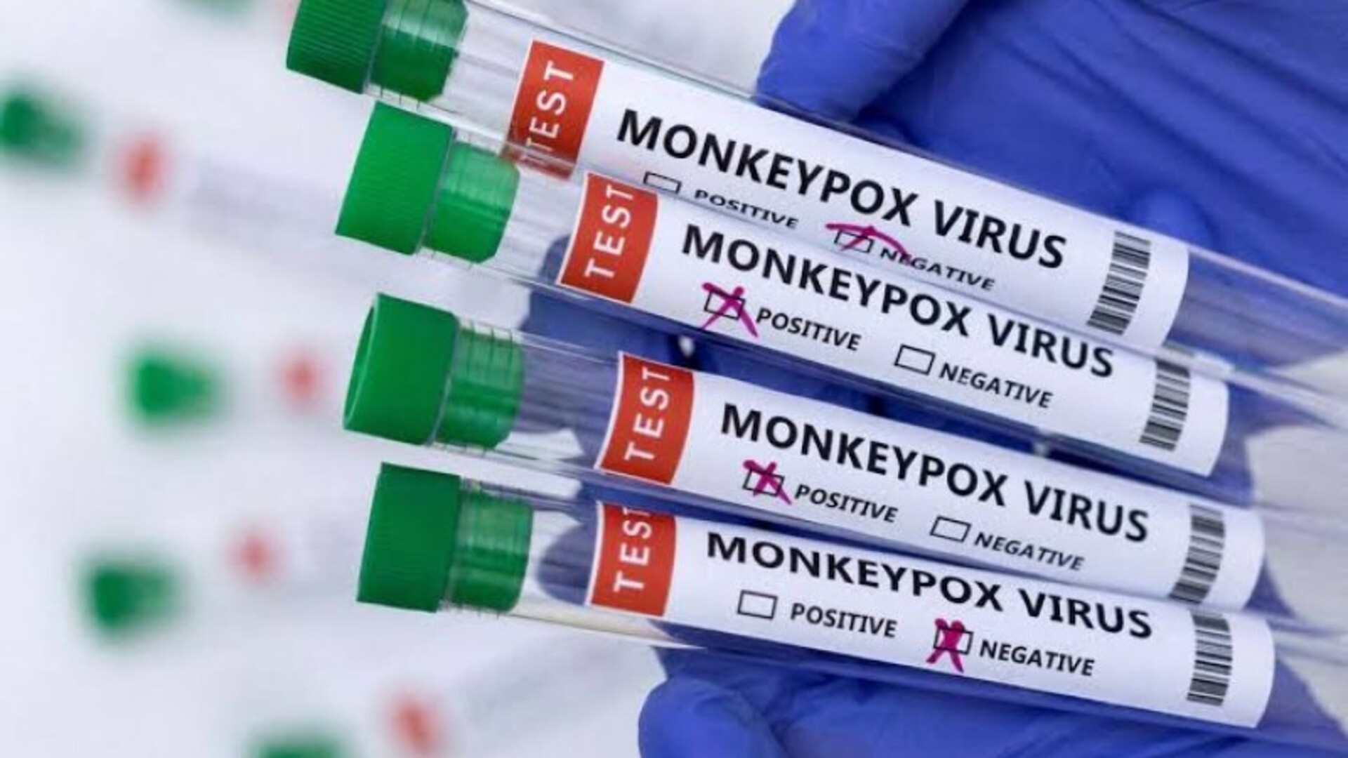 O sequenciamento do vírus permitiu aos pesquisadores esclarecer um caso de contaminação e adotar novas medidas de proteção.