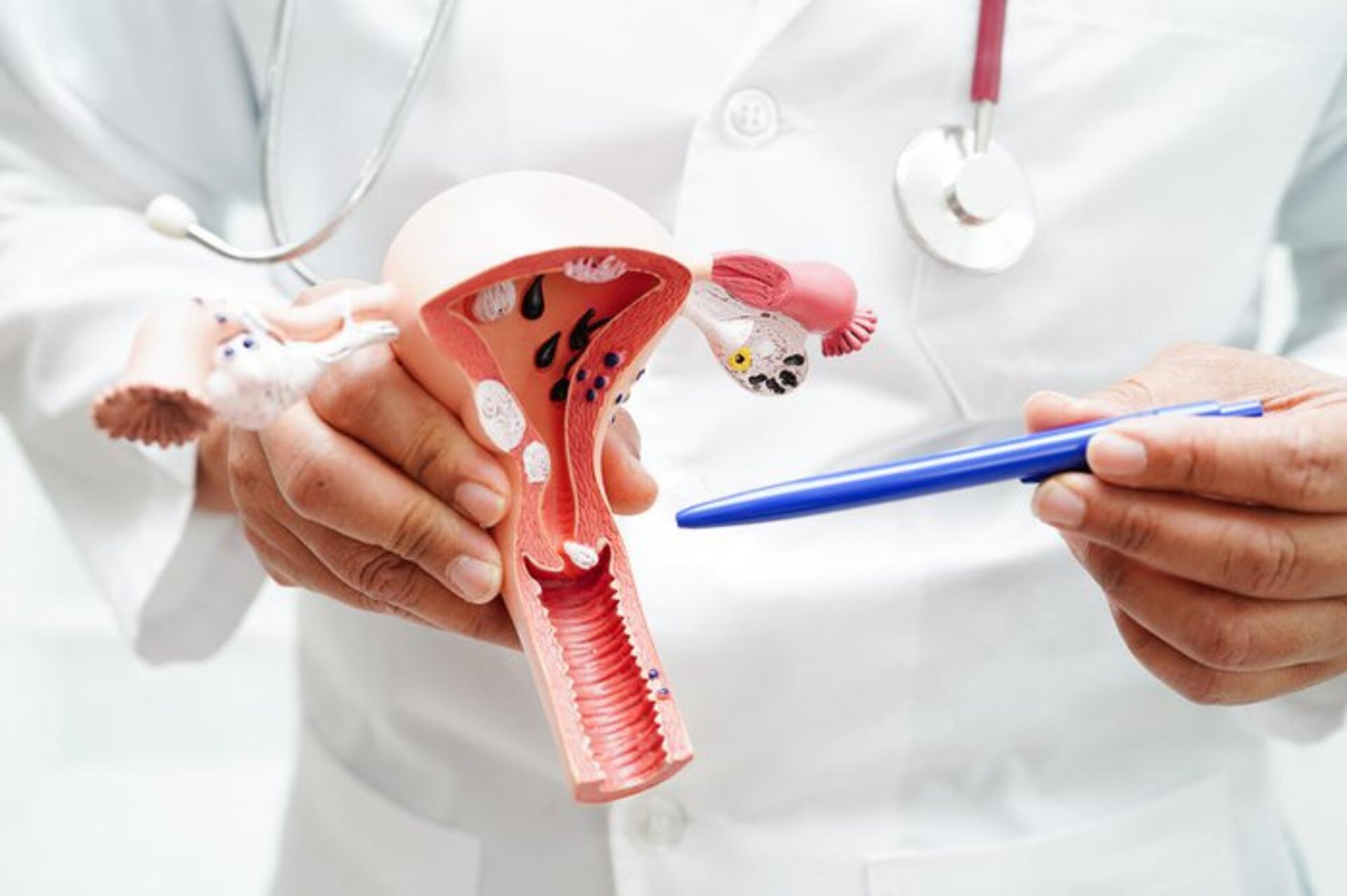 Especialista afirma que em torno de 70% a 80% da população já teve algum contato com o vírus que causa o tumor.