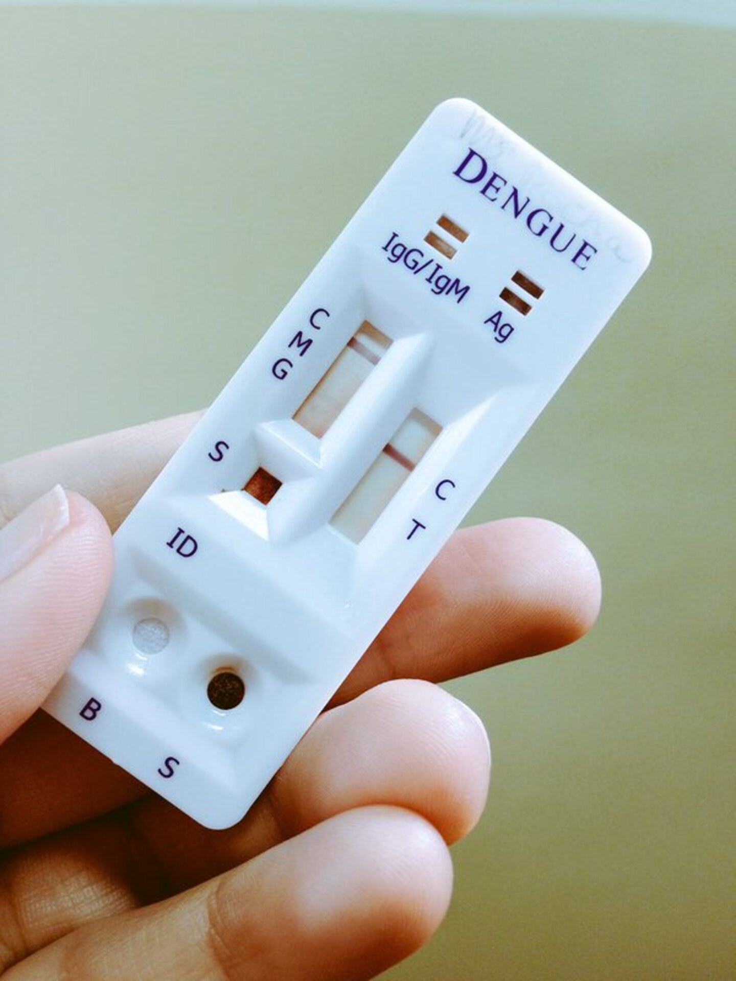 OAB Barro Preto - Testes para dengue são realizados de acordo com os protocolos, afirma secretária