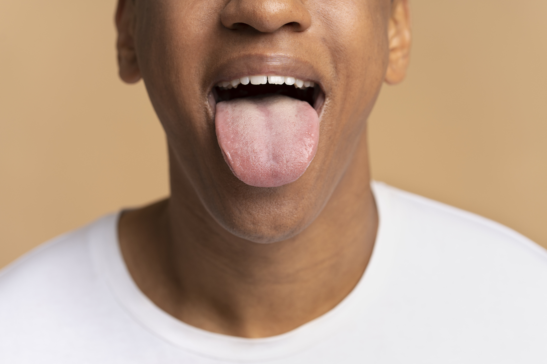 OAB Barro Preto - Quais os sintomas e como prevenir