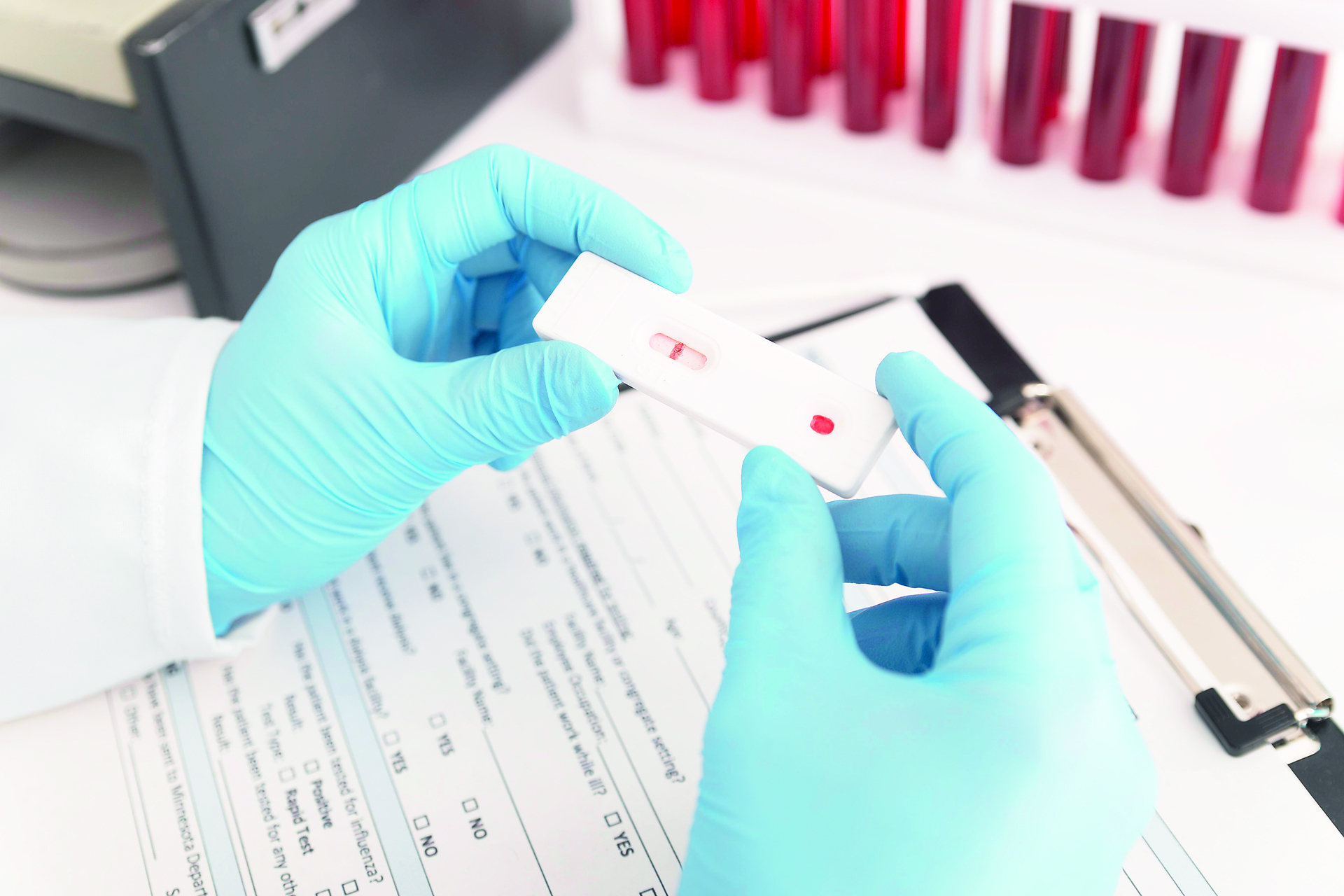 OAB Barro Preto - Testes rápidos estão disponíveis em todas as ESFs de Uruguaiana