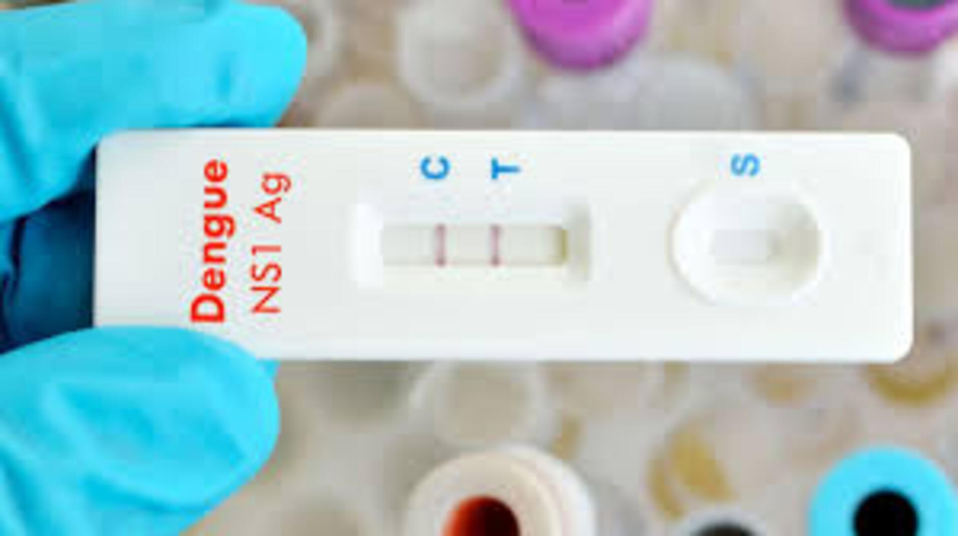 OAB Barro Preto - Ministério da Saúde anuncia distribuição de 6,5 milhões testes rápidos