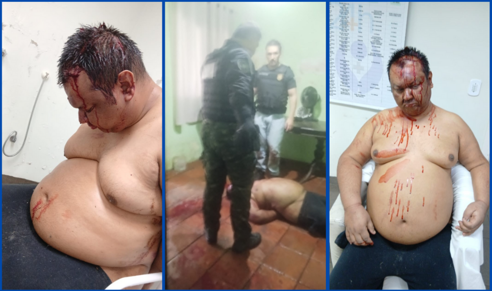 OAB Barro Preto - Polícia Civil espanca homem com esquizofrenia